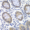 Immunohistochemistry of paraffin-embedded Human colon using GTF2F2 Polyclonal Antibody at dilution of  1:200 (40x lens).