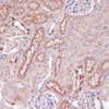 Immunohistochemistry of paraffin-embedded Mouse kidney using LYZ Polyclonal Antibody at dilution of  1:100 (40x lens).