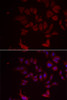 Immunofluorescence analysis of MCF-7 cells using RPL11 Polyclonal Antibody