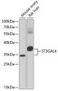 Western blot analysis of extracts of various cell lines using ST3GAL4 Polyclonal Antibody at dilution of 1:1000.