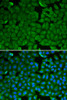 Immunofluorescence analysis of HeLa cells using SPINK1 Polyclonal Antibody