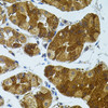 Immunohistochemistry of paraffin-embedded Human stomach using CETP Polyclonal Antibody