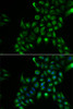 Immunofluorescence analysis of U2OS cells using TSPAN7 Polyclonal Antibody