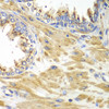 Immunohistochemistry of paraffin-embedded Human prostate using PICK1 Polyclonal Antibody at dilution of  1:100 (40x lens).