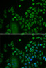 Immunofluorescence analysis of HeLa cells using LSM4 Polyclonal Antibody at dilution of  1:50. Blue: DAPI for nuclear staining.