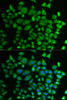 Immunofluorescence analysis of HeLa cells using P4HTM Polyclonal Antibody