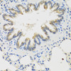 Immunohistochemistry of paraffin-embedded Rat lung using TICAM1 Polyclonal Antibody at dilution of  1:100 (40x lens).