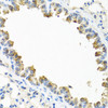 Immunohistochemistry of paraffin-embedded Mouse lung using TICAM1 Polyclonal Antibody at dilution of  1:100 (40x lens).