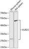 Western blot analysis of extracts of various cell lines using KLRD1 Polyclonal Antibody at dilution of 1:3000.