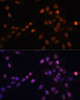 Immunofluorescence analysis of HeLa cells using PRKCB Polyclonal Antibody at dilution of  1:100 (40x lens). Blue: DAPI for nuclear staining.