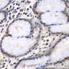 Immunohistochemistry of paraffin-embedded Human colon using PSMB2 Polyclonal Antibody at dilution of  1:100 (40x lens).