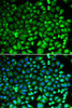 Immunofluorescence analysis of MCF-7 cells using PSMB2 Polyclonal Antibody