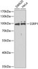 Western blot analysis of extracts of various cell lines using SSRP1 Polyclonal Antibody at dilution of 1:1000.