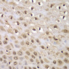 Immunohistochemistry of paraffin-embedded Human esophagus using INTS5 Polyclonal Antibody at dilution of  1:100 (40x lens).