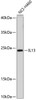 Western blot analysis of extracts of NCI-H460 cells using IL13 Polyclonal Antibody.