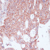 Immunohistochemistry of paraffin-embedded Human colon carcinoma using RPL30 Polyclonal Antibody at dilution of  1:100 (40x lens).