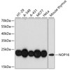 Western blot analysis of extracts of various cell lines using NOP16 Polyclonal Antibody at dilution of 1:3000.