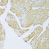 Immunohistochemistry of paraffin-embedded Rat heart using DENR Polyclonal Antibody at dilution of  1:150 (40x lens).