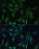 Immunofluorescence analysis of U-2 OS cells using CAMLG Polyclonal Antibody at dilution of  1:100 (40x lens). Blue: DAPI for nuclear staining.