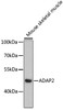 Western blot analysis of extracts of Mouse skeletal muscle using ADAP2 Polyclonal Antibody at dilution of 1:3000.