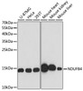 Western blot analysis of extracts of various cell lines using NDUFB4 Polyclonal Antibody at dilution of 1:3000.