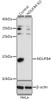 Western blot analysis of extracts from normal (control) and NDUFB4 knockout (KO) HeLa cells using NDUFB4 Polyclonal Antibody at dilution of 1:1000.