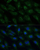 Immunofluorescence analysis of U-2 OS cells using NDUFB4 Polyclonal Antibody at dilution of  1:100 (40x lens). Blue: DAPI for nuclear staining.