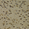 Immunohistochemistry of paraffin-embedded Mouse brain using OGG1 Polyclonal Antibody at dilution of  1:200 (40x lens).