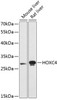 Western blot analysis of extracts of various cell lines using HOXC4 Polyclonal Antibody at dilution of 1:3000.