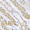 Immunohistochemistry of paraffin-embedded Human stomach using FA2H Polyclonal Antibody at dilution of  1:150 (40x lens).
