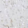 Immunohistochemistry of paraffin-embedded Rat brain using FA2H Polyclonal Antibody at dilution of  1:150 (40x lens).