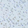 Immunohistochemistry of paraffin-embedded Rat brain using KNG1 Polyclonal Antibody at dilution of  1:100 (40x lens).