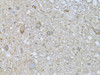 Immunohistochemistry of paraffin-embedded Rat spinal cord using PHLDA2 Polyclonal Antibody at dilution of  1:100 (40x lens).