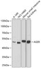 Western blot analysis of extracts of various cell lines using AGER Polyclonal Antibody at dilution of 1:1000.