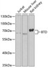 Western blot analysis of extracts of various cell lines using BTD Polyclonal Antibody at dilution of 1:1000.