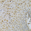 Immunohistochemistry of paraffin-embedded Human esophagus using CDA Polyclonal Antibody at dilution of  1:100 (40x lens).