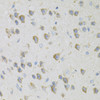 Immunohistochemistry of paraffin-embedded Mouse brain using CDA Polyclonal Antibody at dilution of  1:100 (40x lens).