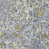 Immunohistochemistry of paraffin-embedded Rat spleen using CEBPE Polyclonal Antibody at dilution of  1:100 (40x lens).