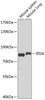 Western blot analysis of extracts of various cell lines using IFI16 Polyclonal Antibody at dilution of 1:1000.