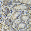 Immunohistochemistry of paraffin-embedded Rat intestine using IFI16 Polyclonal Antibody at dilution of  1:100 (40x lens).