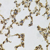 Immunohistochemistry of paraffin-embedded Rat lung using IFI16 Polyclonal Antibody at dilution of  1:100 (40x lens).