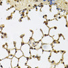 Immunohistochemistry of paraffin-embedded Mouse lung using IFI16 Polyclonal Antibody at dilution of  1:100 (40x lens).