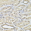 Immunohistochemistry of paraffin-embedded Human kidney using SP110 Polyclonal Antibody at dilution of  1:100 (40x lens).