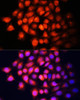 Immunofluorescence analysis of HeLa cells using IGF2 Polyclonal Antibody at dilution of  1:100 (40x lens). Blue: DAPI for nuclear staining.