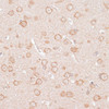 Immunohistochemistry of paraffin-embedded Rat brain using KCNJ4 Polyclonal Antibody at dilution of  1:100 (40x lens).
