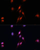 Immunofluorescence analysis of HeLa cells using Smad5 Polyclonal Antibody at dilution of  1:100 (40x lens). Blue: DAPI for nuclear staining.