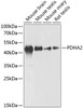 Western blot analysis of extracts of various cell lines using PDHA2 Polyclonal Antibody at dilution of 1:1000.