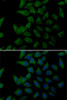 Immunofluorescence analysis of U2OS cells using PLOD2 Polyclonal Antibody