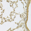 Immunohistochemistry of paraffin-embedded Rat lung using PSMA5 Polyclonal Antibody at dilution of  1:100 (40x lens).