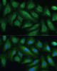 Immunofluorescence analysis of U-2 OS cells using PTPN22 Polyclonal Antibody at dilution of  1:100. Blue: DAPI for nuclear staining.